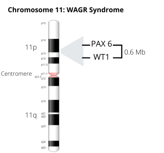 Chromosome_11_WAGR_(2).png