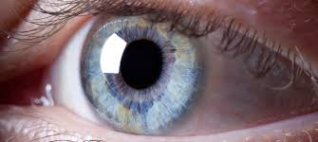 Image of Non-Aniridic Eye