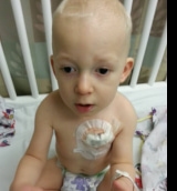 Wes during treatment