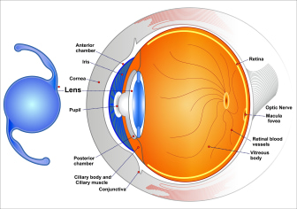 Placement of IOL